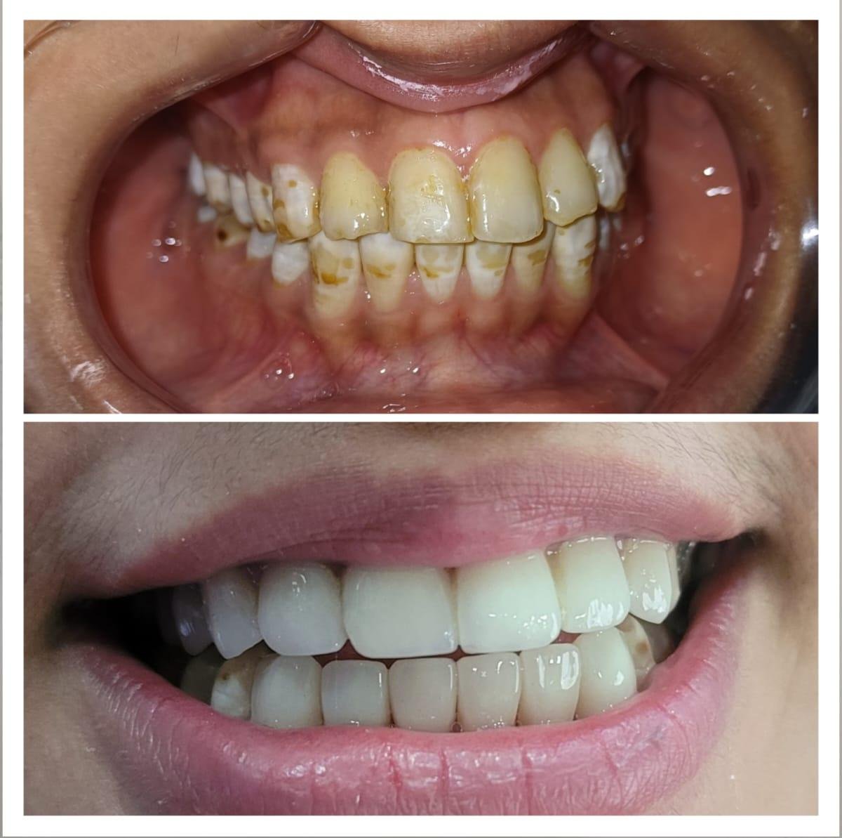 Dental implant case
