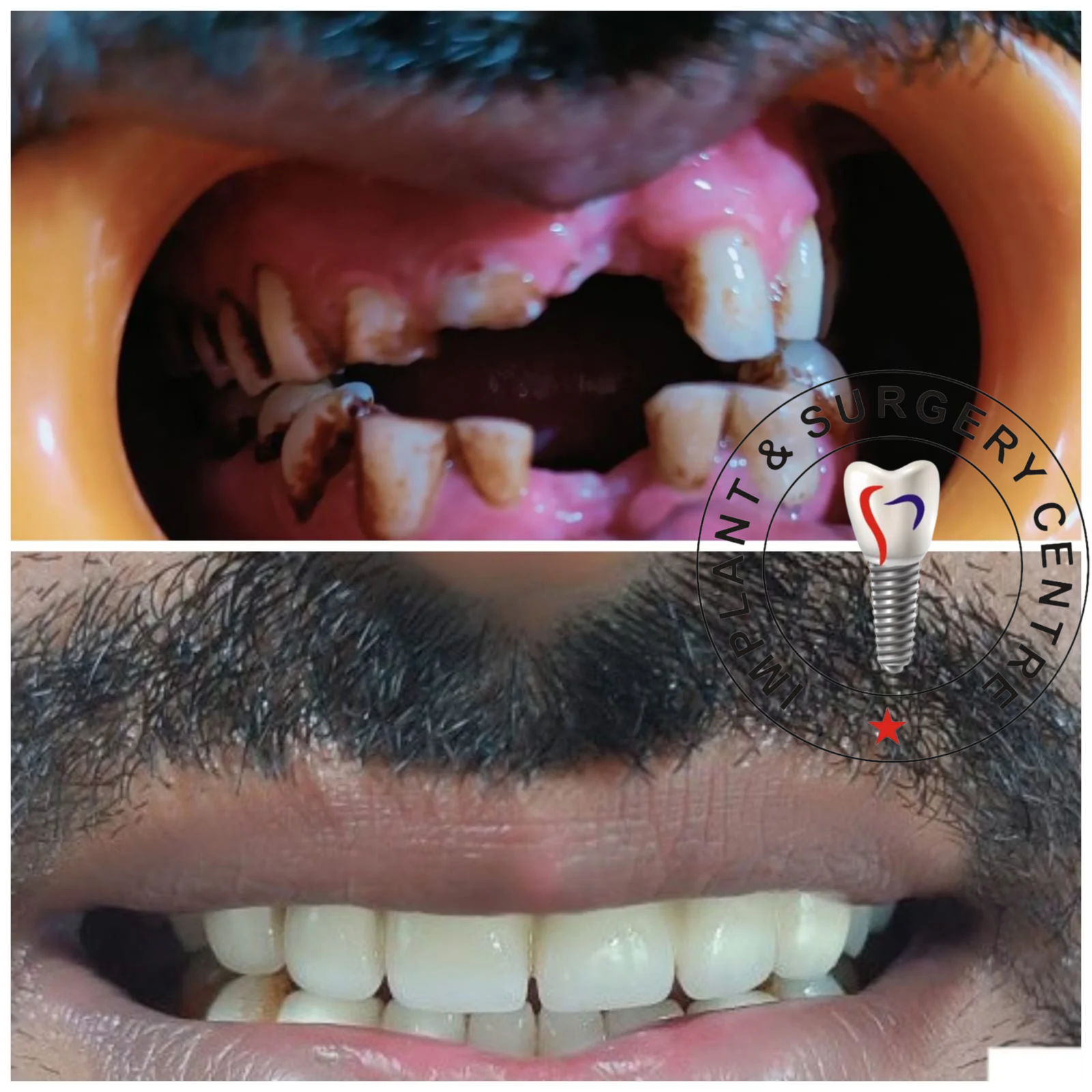 Before and after transformation 3