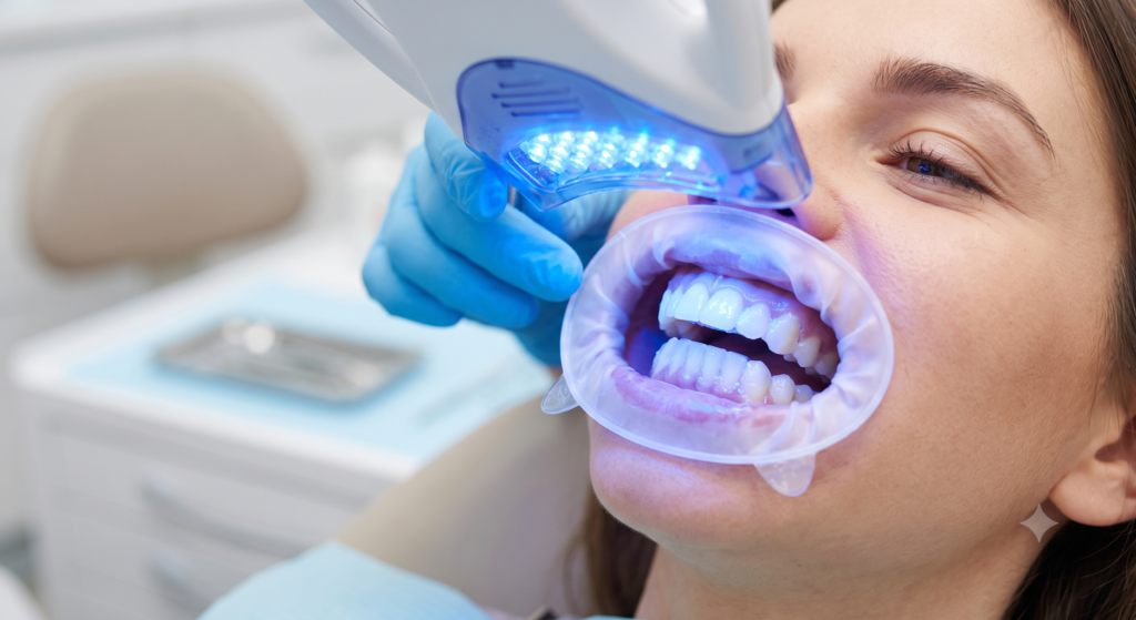 teeth whitening